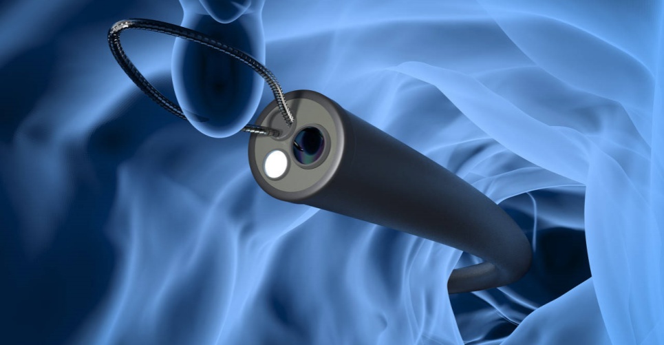 endoscope.jpg